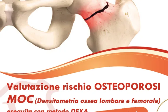 Prevenzione osteoporosi